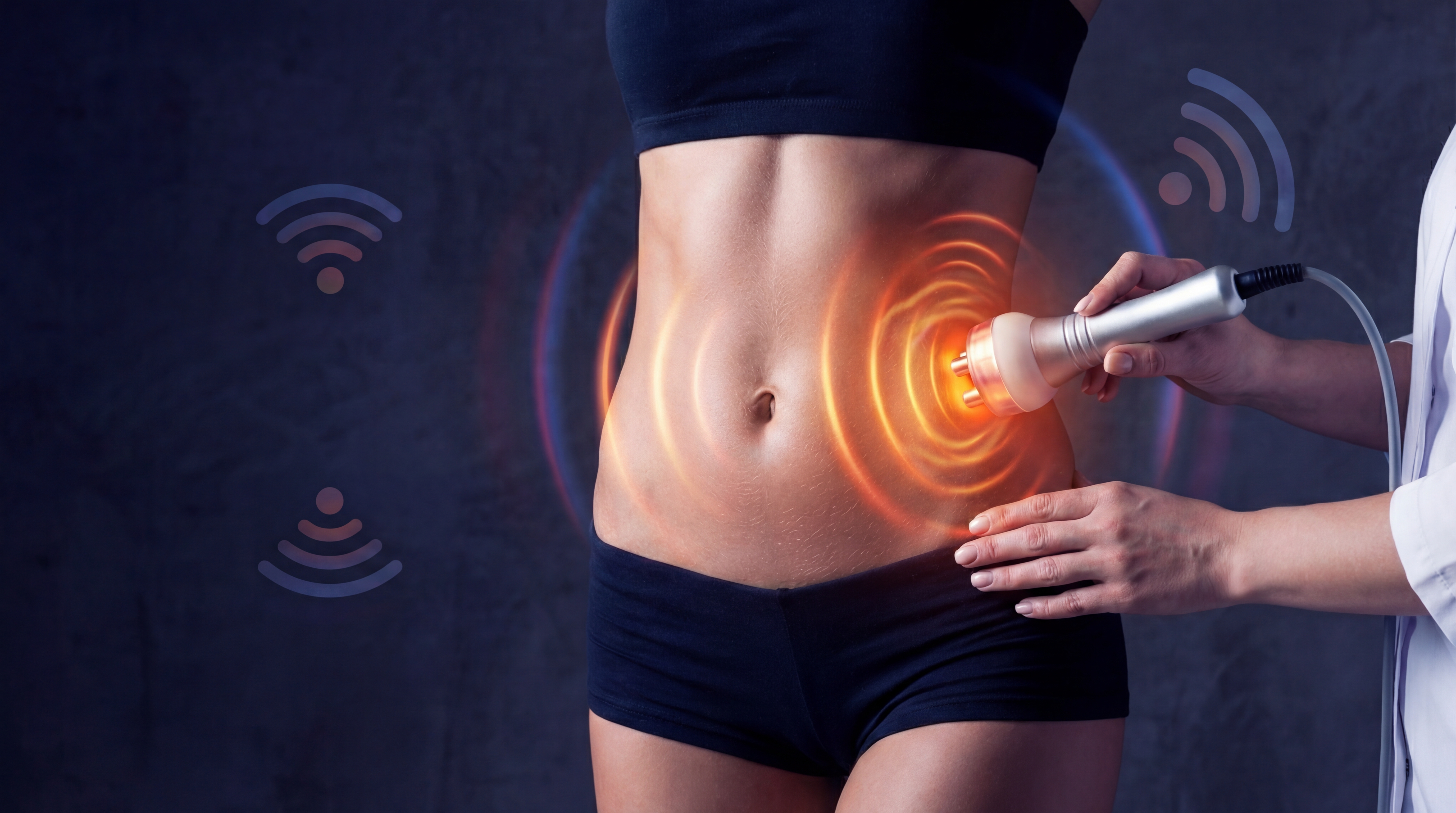 Radiofrequency Treatment