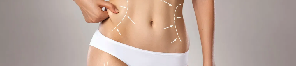 Liposuction